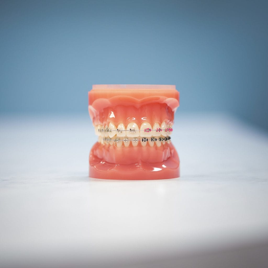 Life With Braces HentscherJohnson Orthodontics