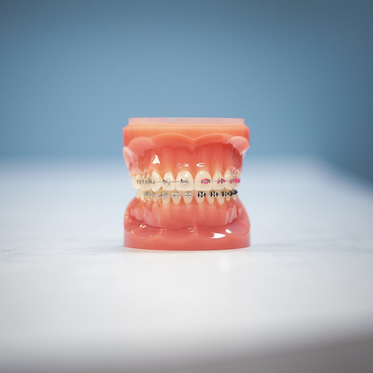 New Athens Orthodontist Hentscher Johnson Orthodontics Columbia Illinois Types of Orthodontic Braces 7 square - New Athens Orthodontist