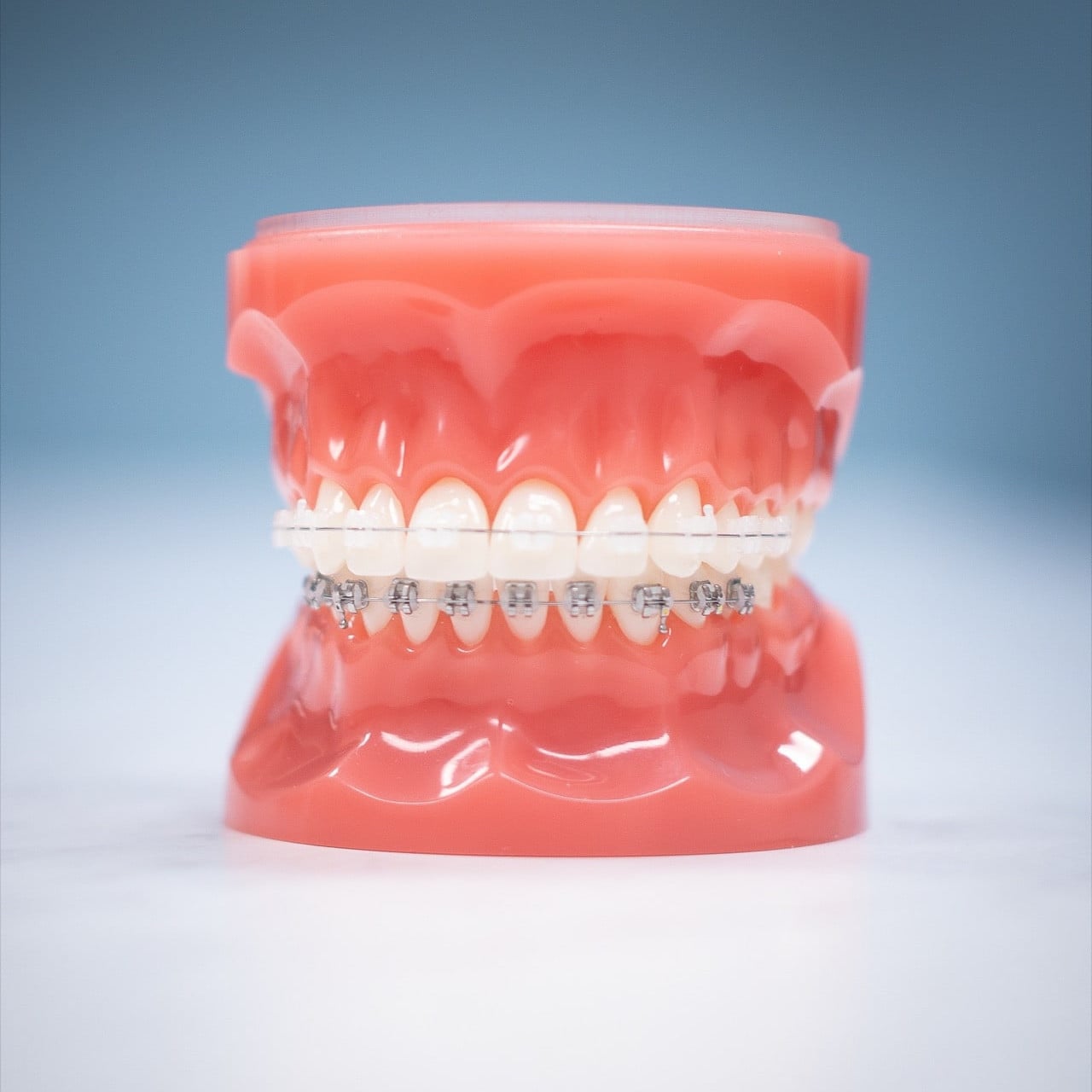 New Athens Orthodontist Hentscher Johnson Orthodontics Columbia Illinois Types of Orthodontic Braces 66 square - New Athens Orthodontist