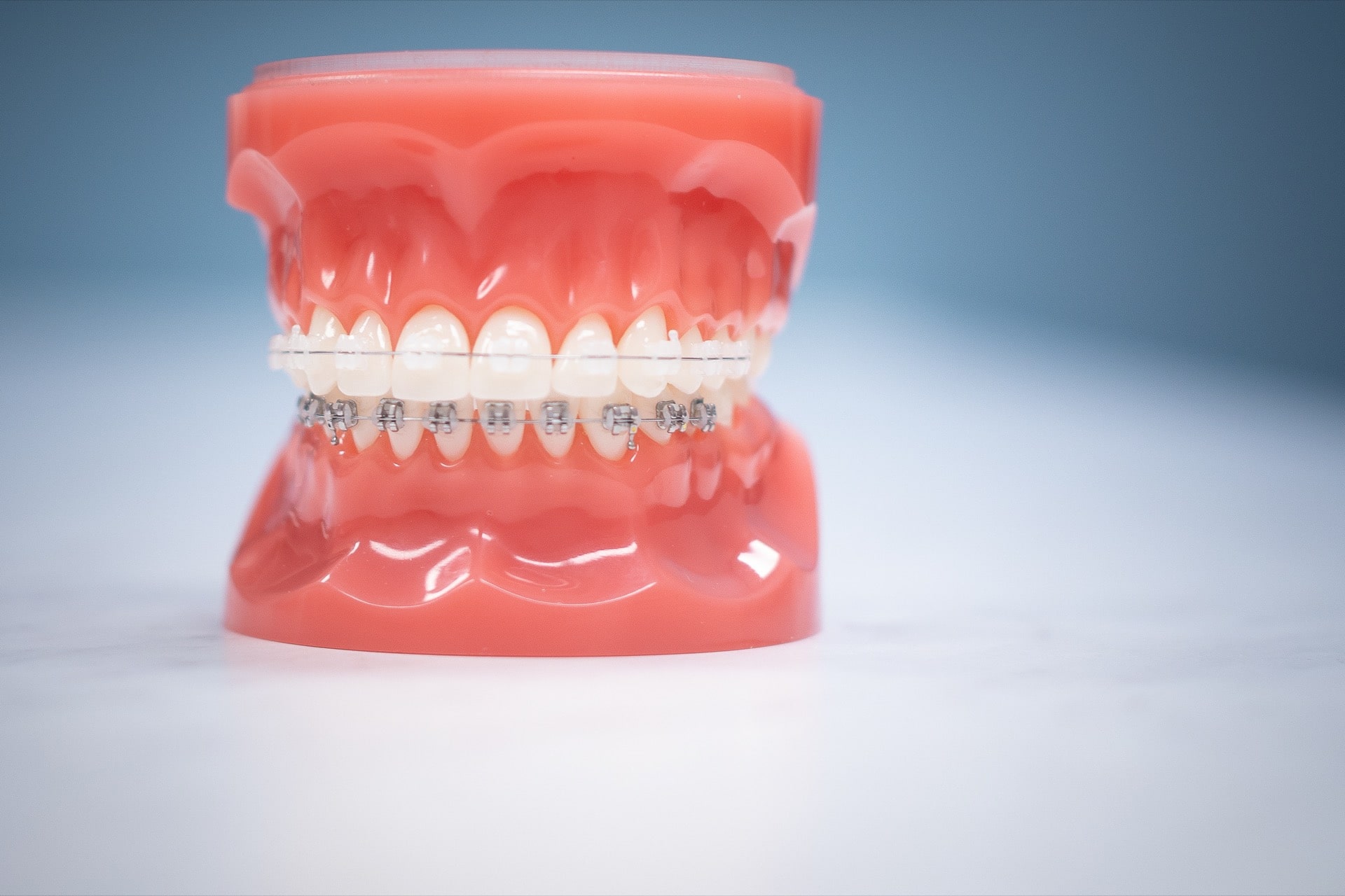 How Do Braces Work? Things to Know About Orthodontics