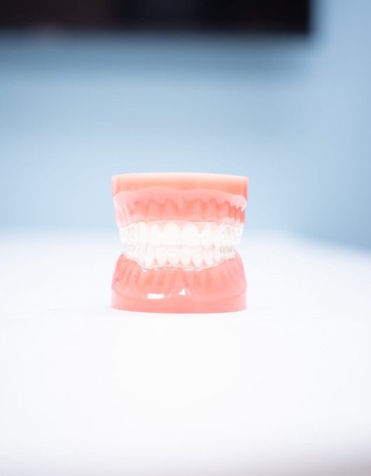 Hentscher Johnson Orthodontics Columbia Illinois Types of Orthodontic Braces 72 square 530x680 - Clear Aligners