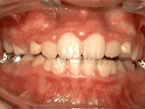 phase 1 after - Common Treatments