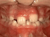 phase 1 before - Common Treatments